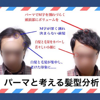 M字 前髪 パーマと考える 髪型分析 Inti Report 薄毛に悩む男性の為の美容院 Inti インティ 全席個室 東京 大阪 福岡に展開